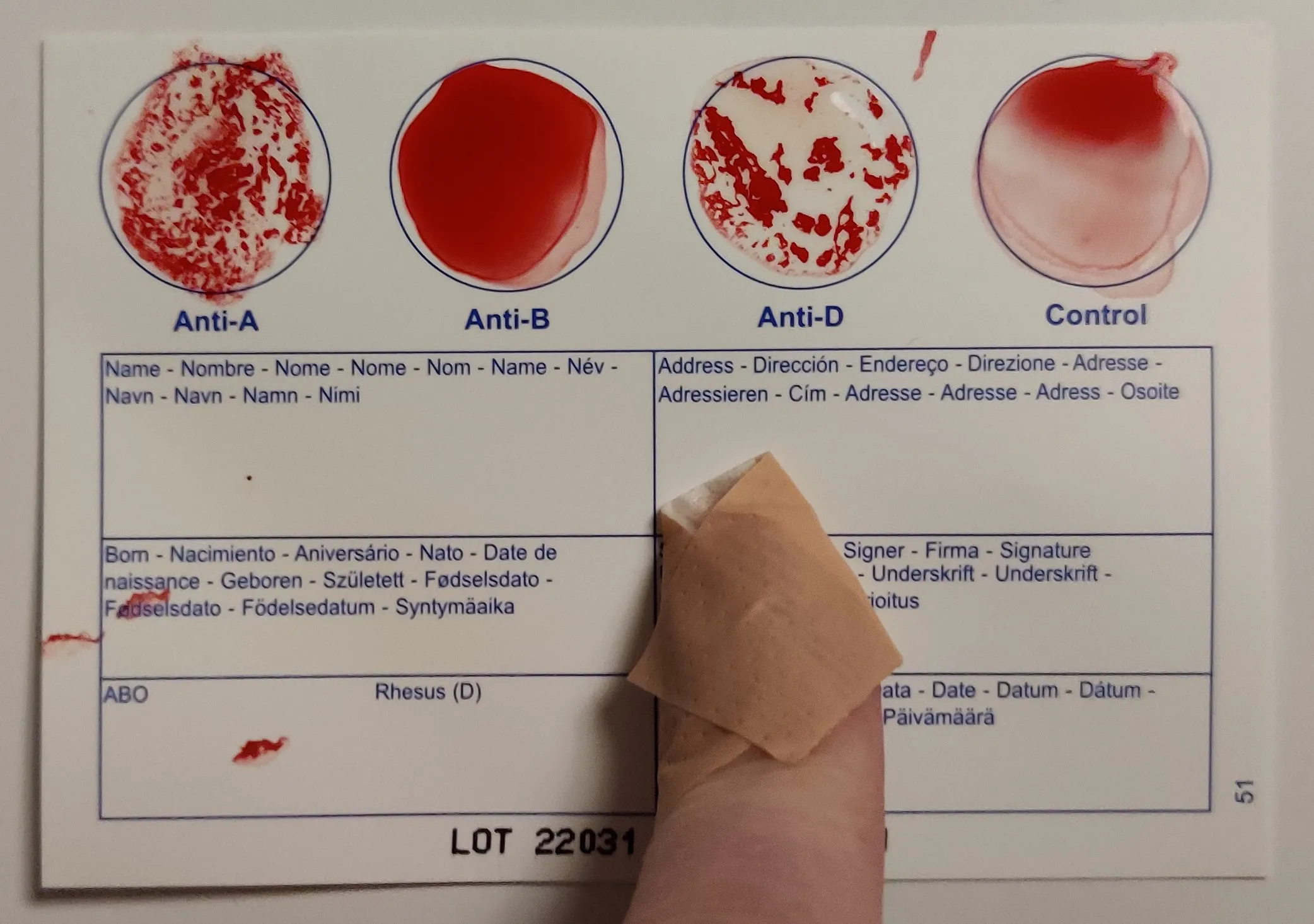 Used Eldoncard with the four circles covered in blood. Bandaged finger shown in foreground.