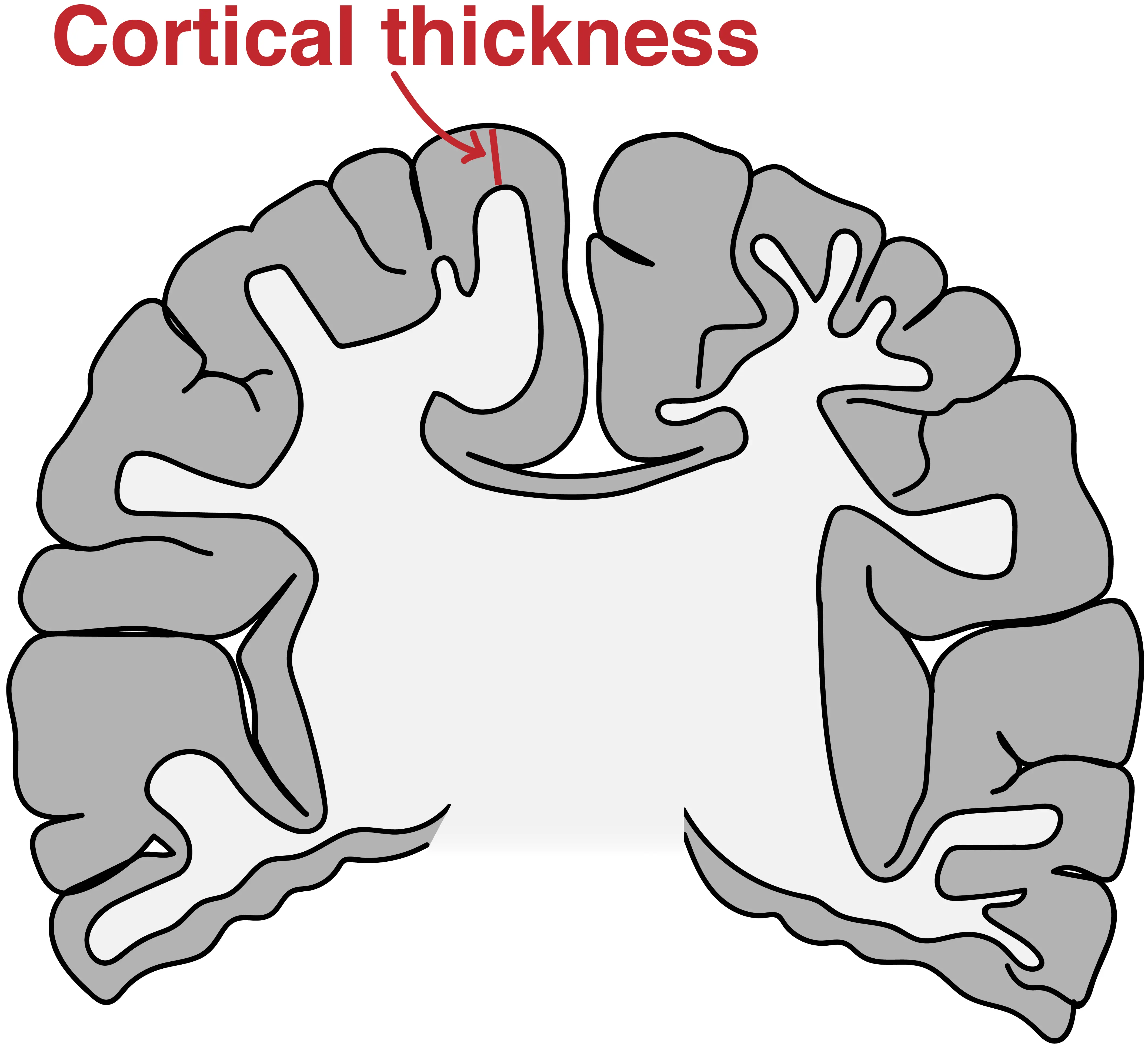 The thick cortex of human brain enables a dense packing of many nerve cells.