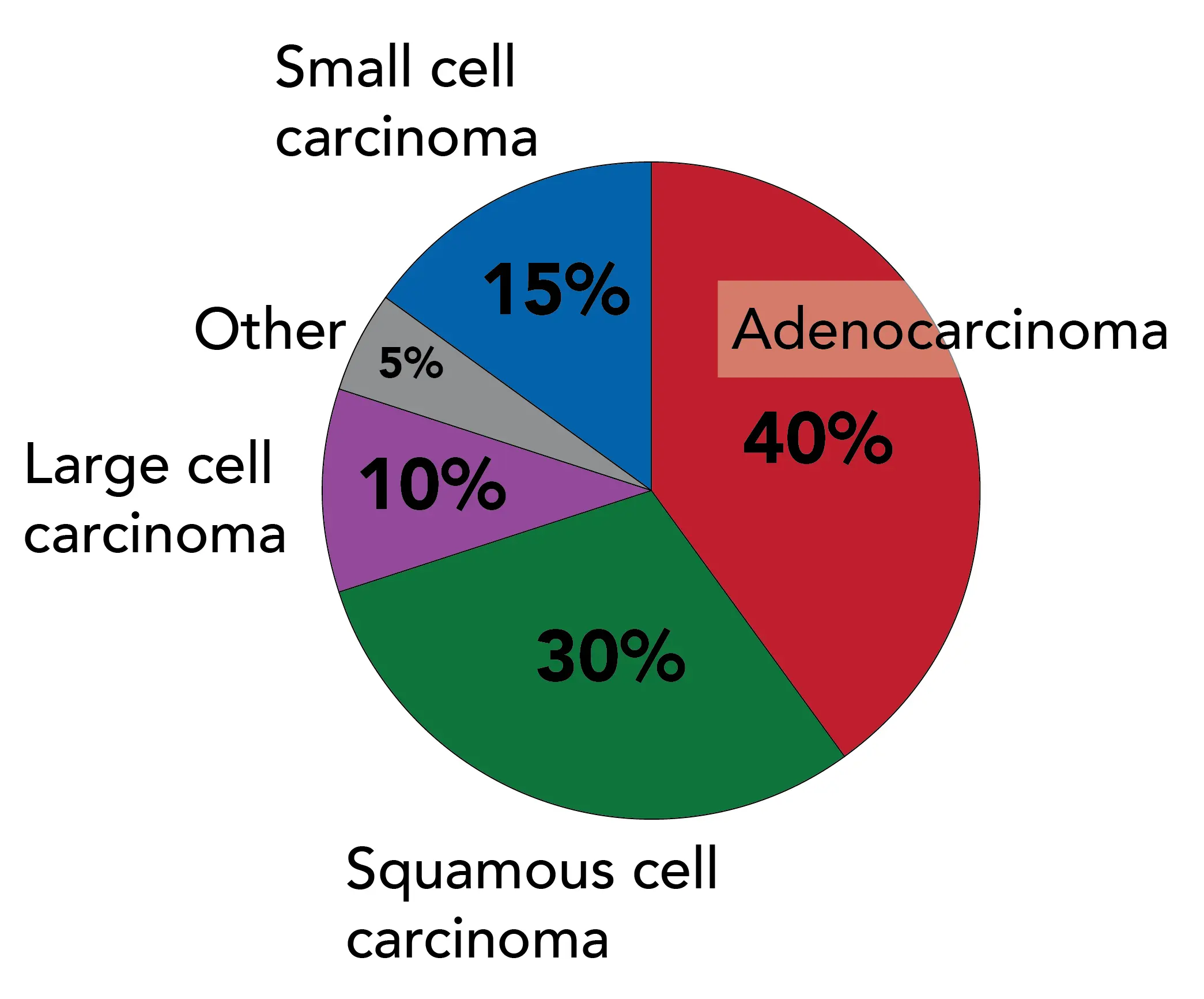 Adenocarcinoma and squamous cell carcinoma are the most common types of lung cancer.