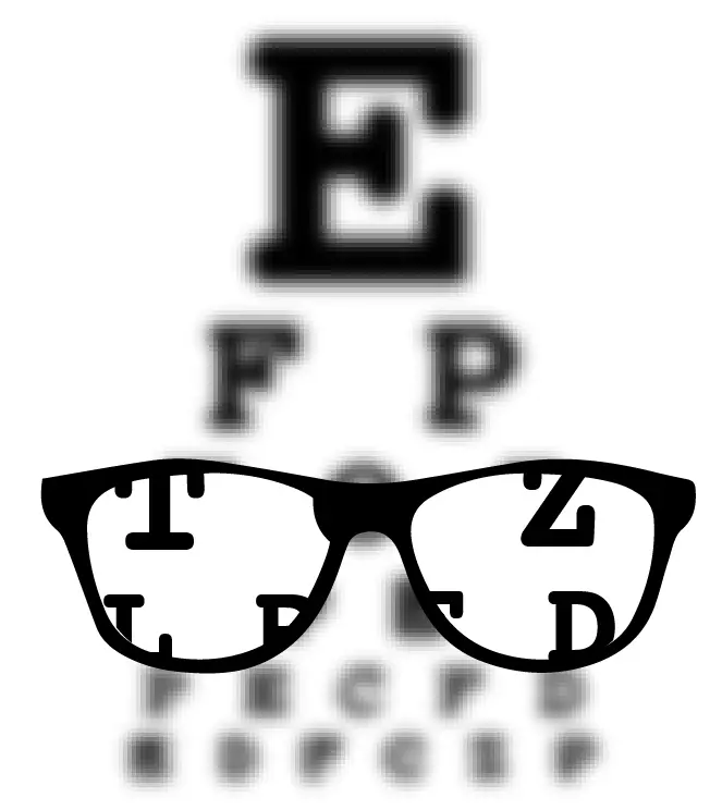 Myopia, or nearsightedness, is the most common refractive error.