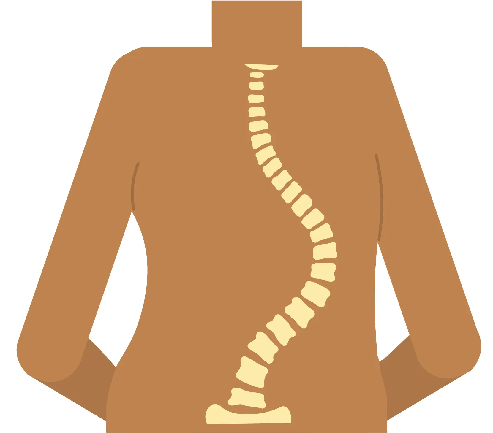 Scoliosis is a sideways curvature of the spine.