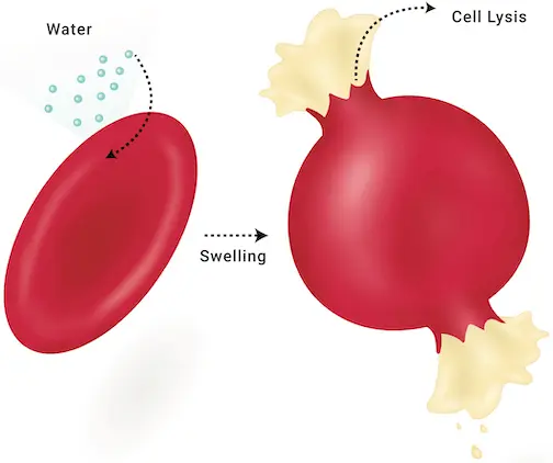 Osmotic hemolysis describes rupturing of red blood cells due to water inflow.