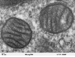 Mitochondria (from an electron microscope)